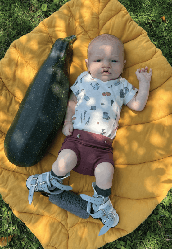 More Childhood Please Magazine - Boy with braces and sq