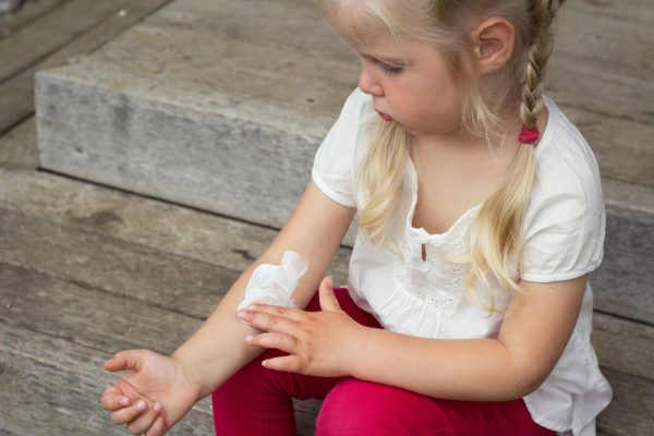 Poison Ivy 101: 5 Ways to Prevent and Treat Your Child’s Poison Ivy Rash