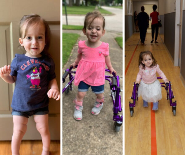 spina bifida, myelo clinic, madelyn traschel, physical therapy
