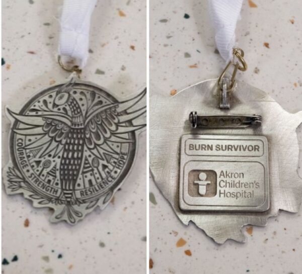 Akron Children's burn survivor medallion