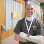 Cameron Costello house fire burn survivor