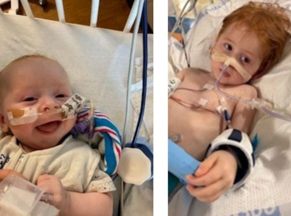 Oliver Wiseman - surgery photos