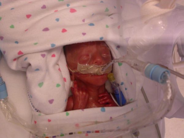 Wynn Stoller - NICU pic1