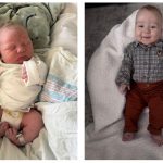 Cohen’s clubfoot care is worth the drive Cohen Bisbal - foot progression collage