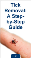 Tick removal: a step=by-step guide