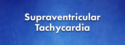 Supraventricular Tachycardia (SVT)