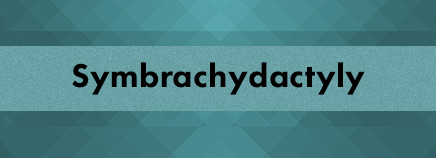 Symbrachydactyly