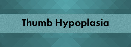 Thumb Hypoplasia