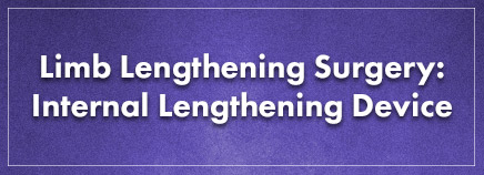 Limb Lengthening Surgery: Internal Lengthening Device