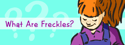 What Are Freckles?