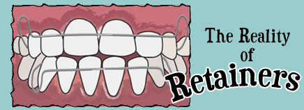 The Reality of Retainers