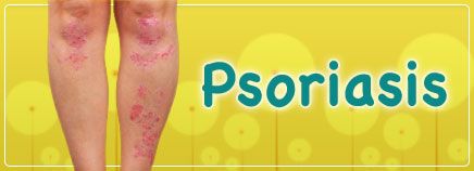 Skin Problem: Psoriasis