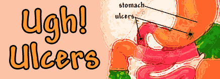 Ugh! Ulcers