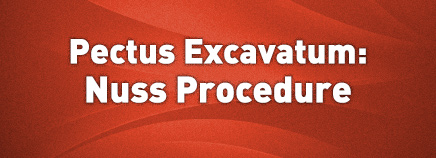 Pectus Excavatum: The Nuss Procedure