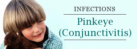 Pinkeye (Conjunctivitis)