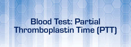 Blood Test: Partial Thromboplastin Time (PTT)
