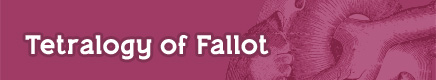 Tetralogy of Fallot (TOF)