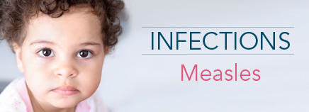 Kidshealth: Measles | Akron Children's Hospital