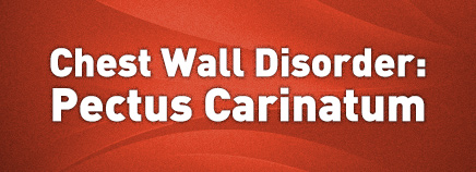 Chest Wall Disorder: Pectus Carinatum