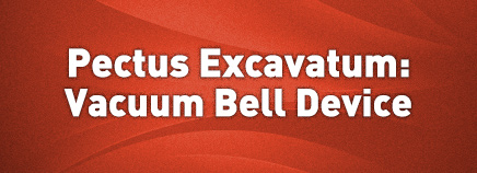 Pectus Excavatum: Vacuum Bell Device