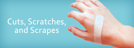 Kidshealth: Cuts, Scratches, and Scrapes | Akron Children's Hospital