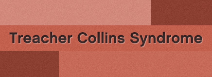 Treacher Collins Syndrome