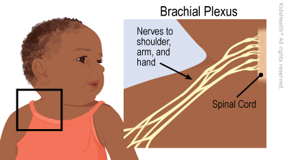 Illustration: brachial plexus