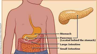 Illustration shows where the pancreas sits behind the stomach