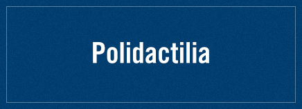 Polidactilia