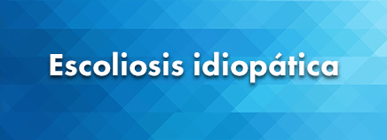 Escoliosis idiopática