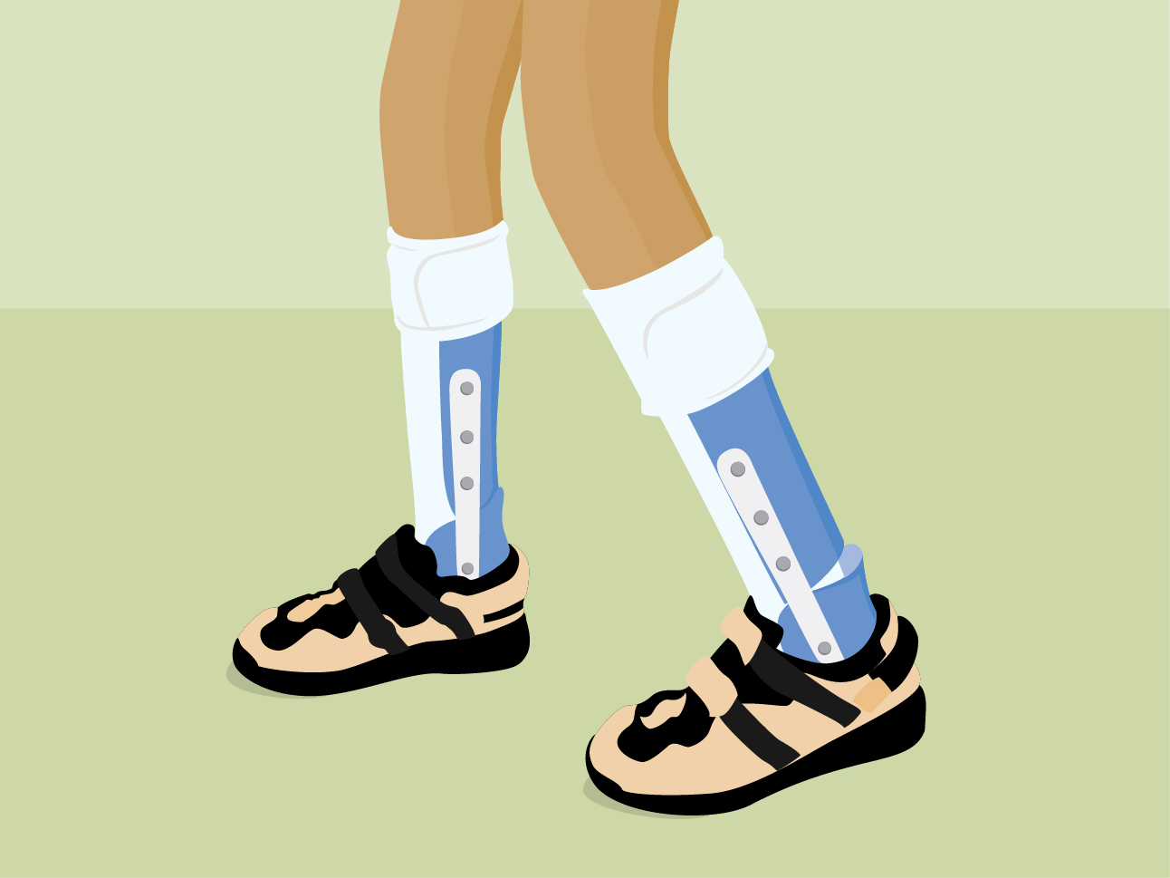 Leg Braces (Orthoses)