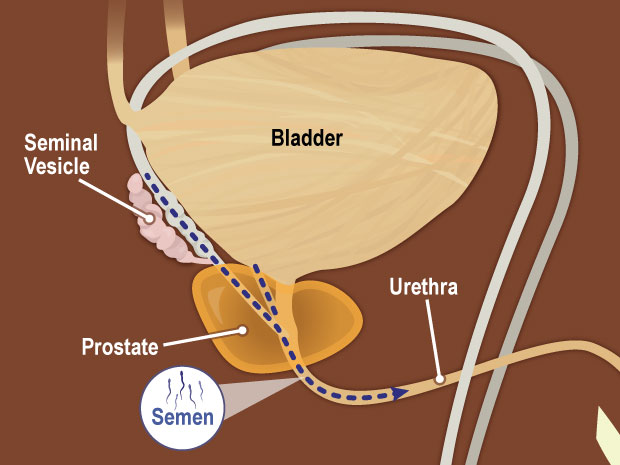 Located at the base of the bladder, the two seminal vesicles secrete a thick fluid that nourishes the sperm. The bladder is the muscular sac that stores urine (pee) until it is released through the urethra. 