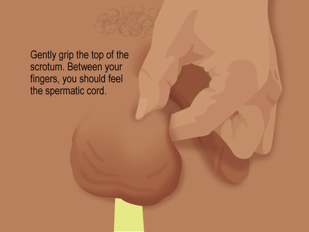 Examine one testicle at a time.Start by gently gripping the top of the scrotum, with your thumb on top and your fingers underneath. Pinch gently so that the testicle stays put and won't move during the exam.Between your fingers, you should feel the spermatic cord. This connects the testicle to the rest of your body.