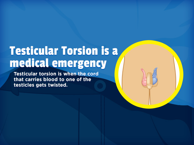 Testicular torsion is when the cord that carries blood to one of the testicles gets twisted.