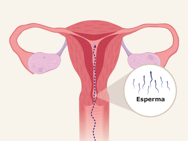 Durante las relaciones sexuales, el esperma pasa por la vagina y el útero hasta llegar a las trompas de Falopio.En la trompa de Falopio, el esperma se une con el óvulo que se liberó durante la ovulación del ovario.