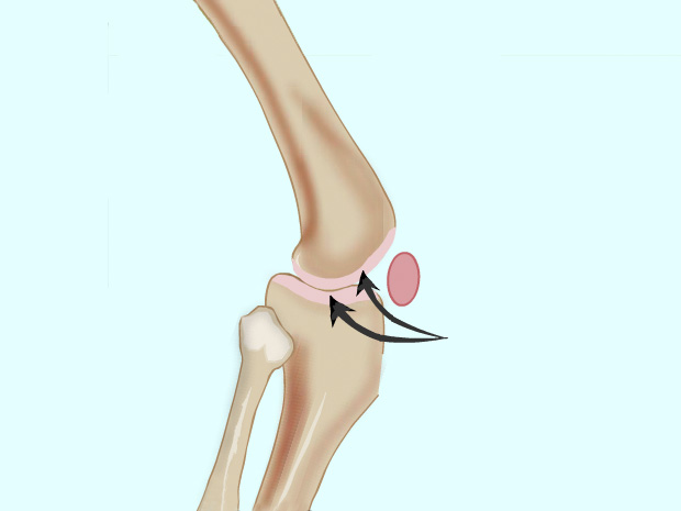 Los cartílagos (tejido flexible y grueso ubicado en los extremos de los huesos) protegen a los huesos y les sirven de amortiguación cuando se unen y friccionan uno contra otro en las articulaciones.