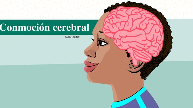 Conmoción cerebral