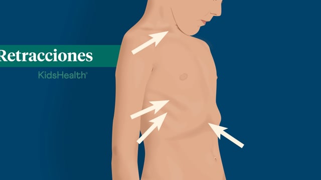 Retracciones