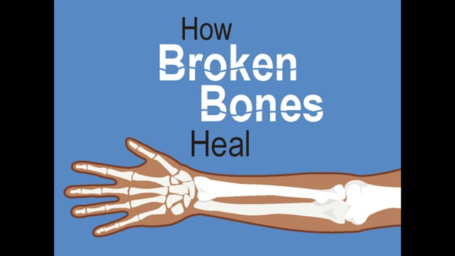 How Bones Heal