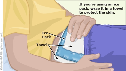 ice pack hip