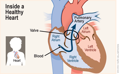 Two diagrams show the position of the heart in the body and a close-up, cross section of a healthy heart. Blood flows from the right atrium into the right ventricle and through a valve into the pulmonary artery. 