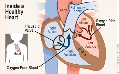 Two diagrams show the position of the heart in the body and a close-up, cross section of a healthy heart. Oxygen-rich blood flows from the left atrium into the left ventricle then on to the aorta, while oxygen-poor blood flows from right atrium into the right ventricle and through a valve into the pulmonary artery. 