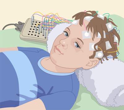 EEG_illustration
