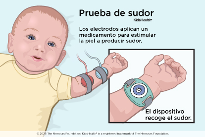Un niño haciéndose la prueba de sudor