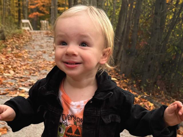 Marty Joe overcomes clubfeet and clefts